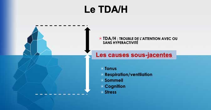 004 Le TDAH causes et conséquences