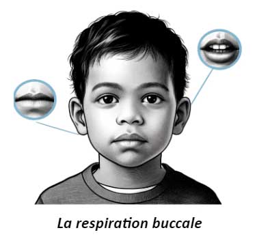 007 La respiration buccale