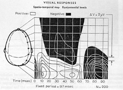 Le neurofeedback : moduler les rythmes cérébraux, non pour contrôler l’esprit, mais pour soutenir la régulation