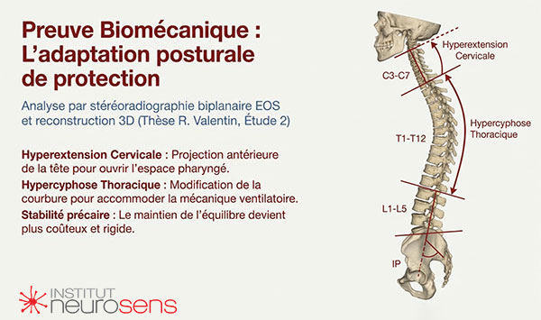 Preuve biomécanique : L'adaptation posturale de protection