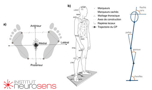 La désorganisation posturale