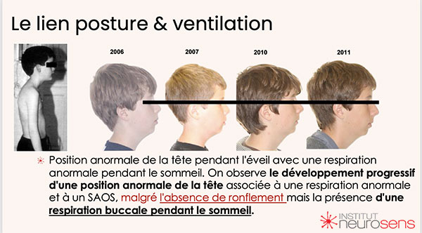 Le lien posture et ventilation