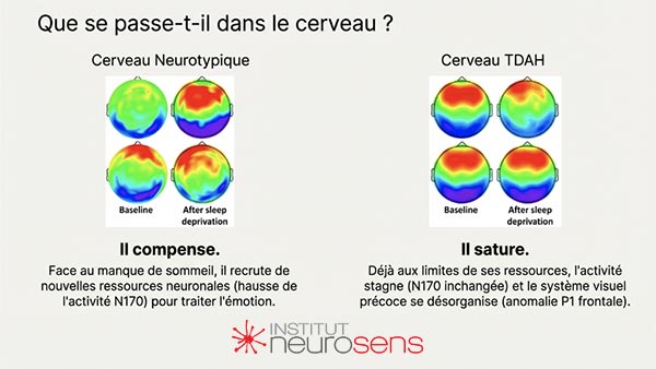Que se passe-t-il dans le cerveau ?