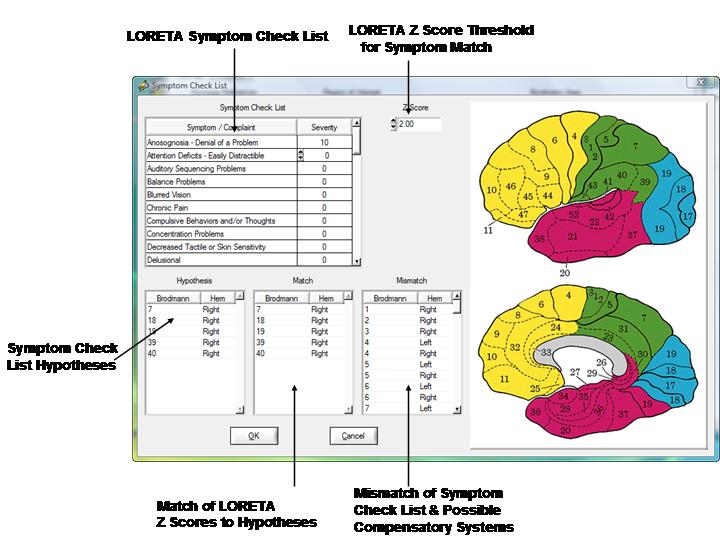 Neurofeedback LORETA Symptom Check List