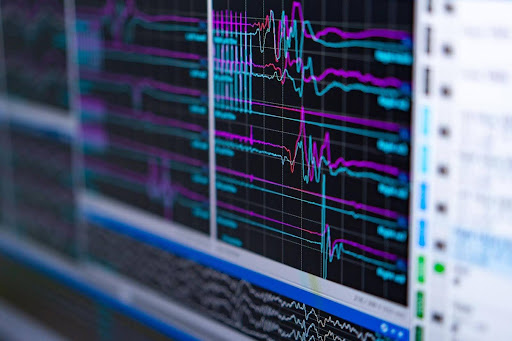 Neurofeedback et régulation