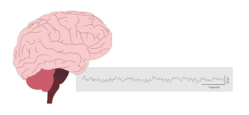 Comprendre le neurofeedback